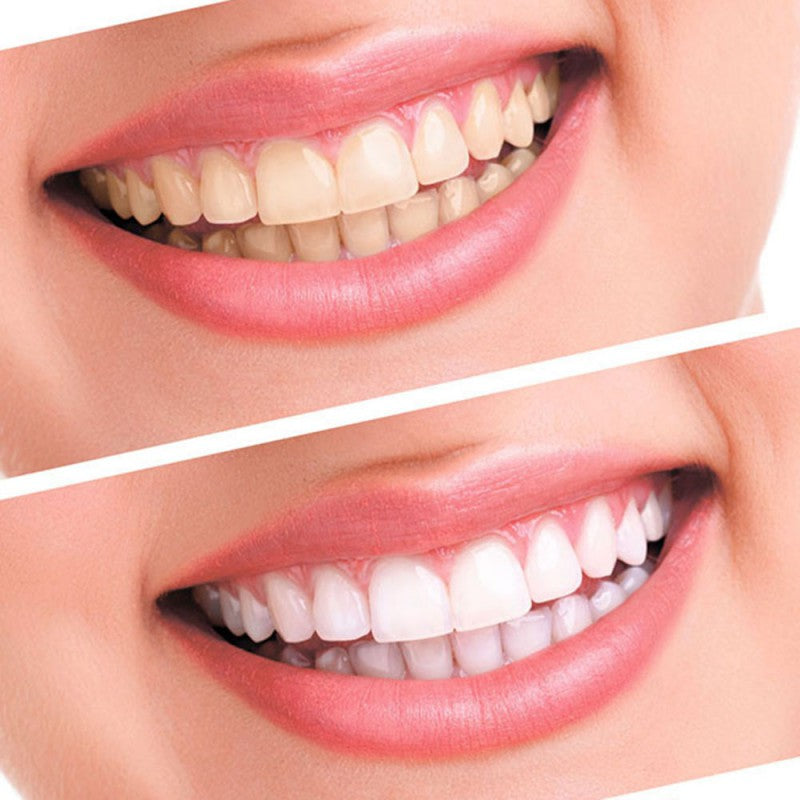 Teeth Whitening Tooth Gel Health Oral Care